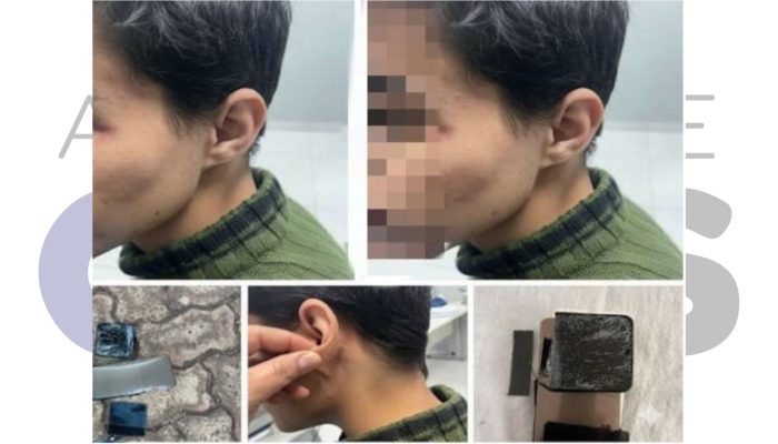 28-08-agressao-estudante-candido-mota-2025