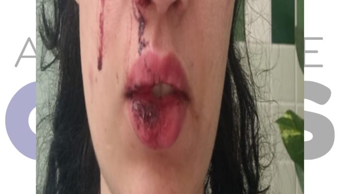 Mulher denuncia agressão de bombeiro militar em Assis. Caso é investigado sob a Lei Maria da Penha e Justiça avalia prisão preventiva do suspeito.