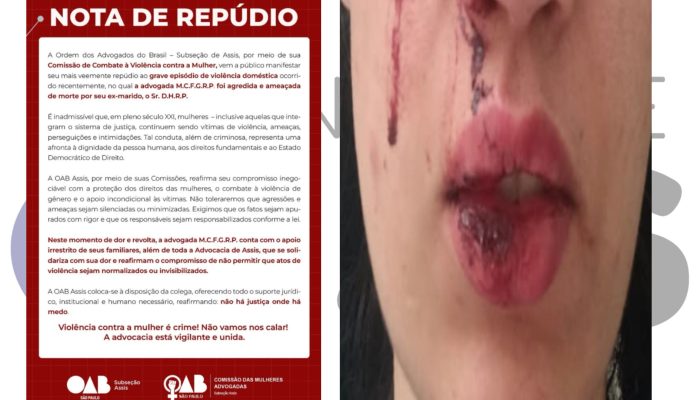 OAB Assis repudia agressão a advogada por ex-marido bombeiro militar e cobra responsabilização. Entidade oferece apoio jurídico e institucional à vítima.